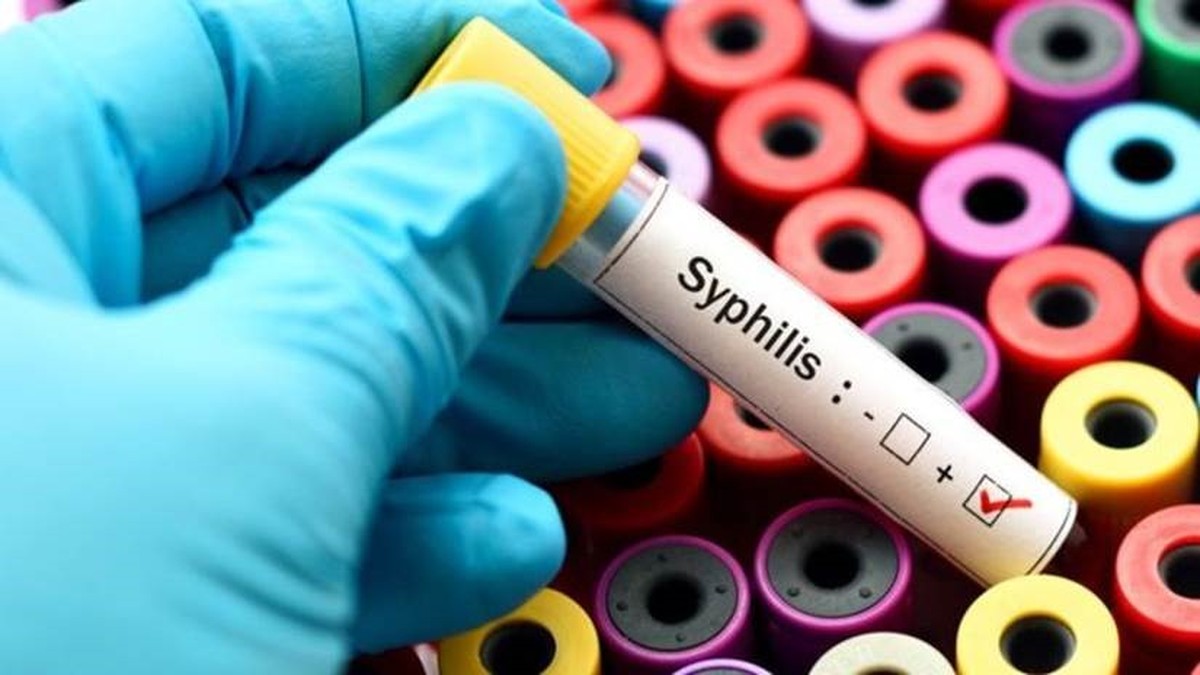O Dia Nacional de Combate à sífilis é neste sábado, 17