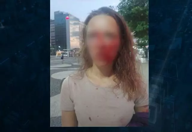 Turistas ficaram com o rosto ensanguentado após agressões. Foto: SBT News/Reprodução

