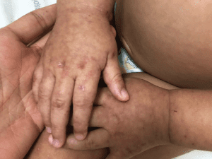 Foto: Sociedade Brasileira de Pediatria | Reprodução
