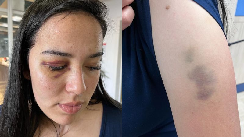 Fotógrafa de Lages foi brutalmente agredida durante uma partida de futsal | Foto: Carolina Sott/Rádio Clube de Lages