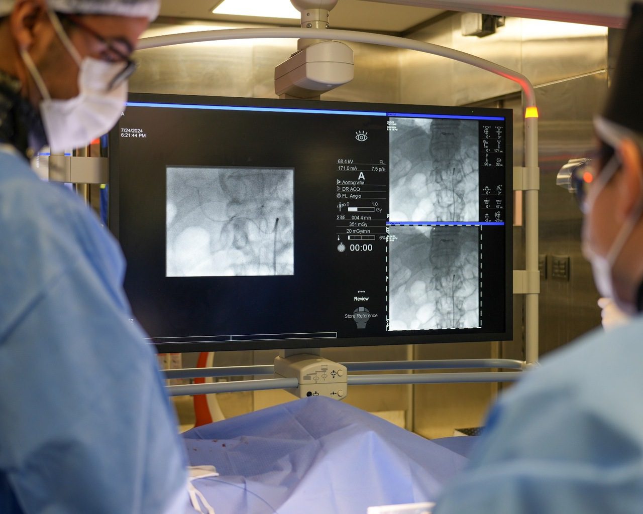 Hospital de SC realiza procedimento pioneiro no Estado para o tratamento do câncer de fígado | Foto: Hospital Baía Sul/Divulgação.