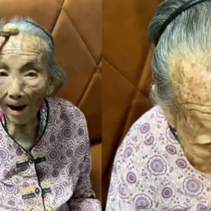 Idosa de 107 anos chama atenção por 'chifre' crescendo na testa | Foto: Reprodução/Redes Sociais 