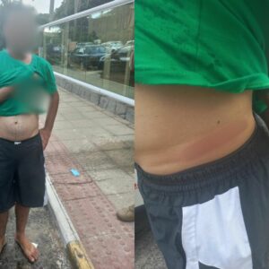 Homem é agredido por moradores após tentar furtar veículo em Florianópolis | Foto: Cedido ao SCC10