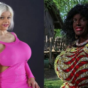 Alemã faz procedimentos para ter pele negra e se declara 'transracial'. - Foto: Internet/Reprodução