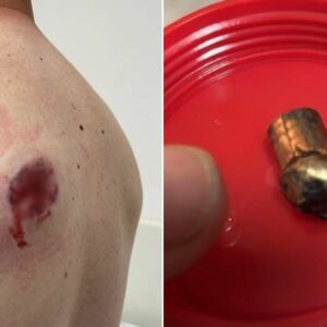 Notebook salva homem baleado durante assalto: veja imagens. - Foto: Metrópoles/Reprodução