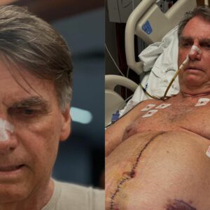 'Um dia de cada vez': Bolsonaro tem melhora clínica após cirurgia, mas segue na UTI. - Redes sociais/Reprodução