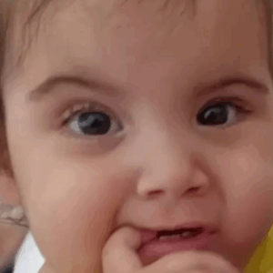 Morre uma das gêmeas siamesas separadas em cirurgia.  - Foto: Reprodução/Internet