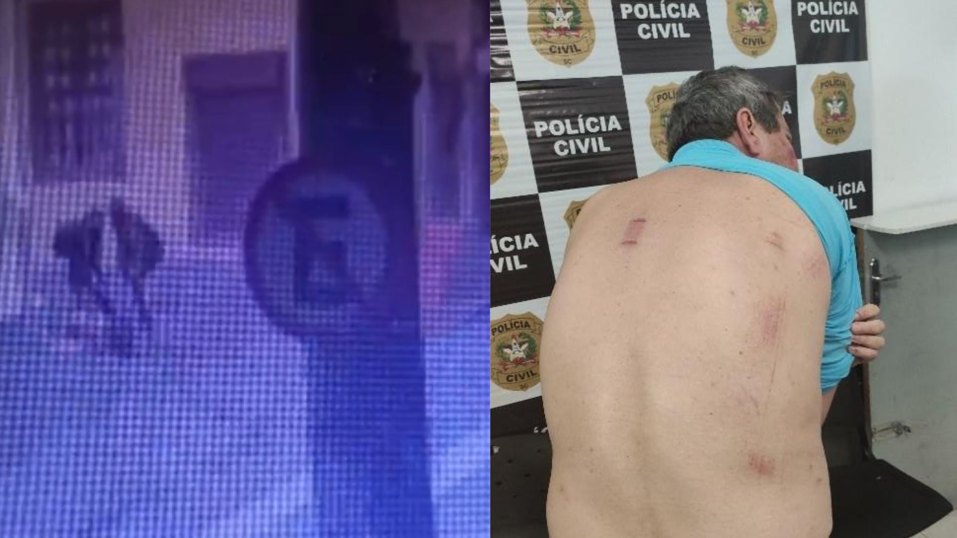 Homem é espancado e roubado por pessoas em situação de rua em Florianópolis | Foto 1: Reprodução/Vídeo | Foto 2: cedida