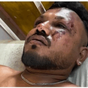 Quem é o sobrevivente de queda de avião na Índia que deixou mais de 200 mortos | Foto: reprodução/Hindustan Times/SBT News
