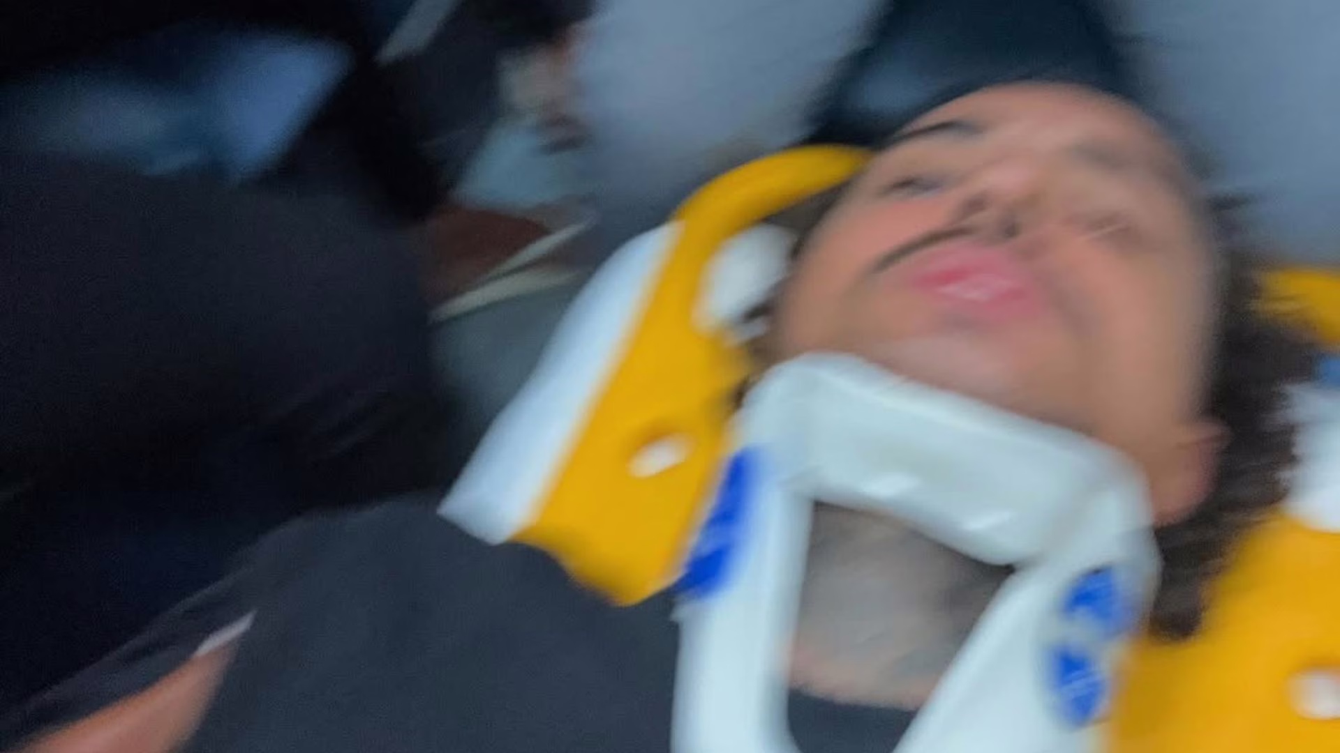 MC Livinho é internado na UTI após acidente de moto perfurar pulmão. – Foto: Reprodução/Redes sociais