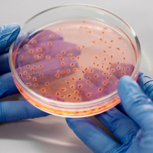 EUA registra morte causada por bactéria que causou pandemia na Idade Média. | Foto: reprodução. 