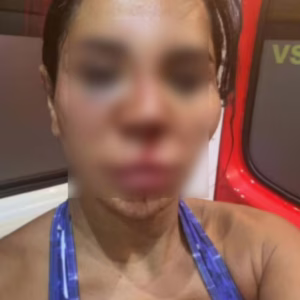 “Tentaram me desfigurar”: influenciadora é espancada dentro da própria casa - Imagem: reprodução/ metrópoles