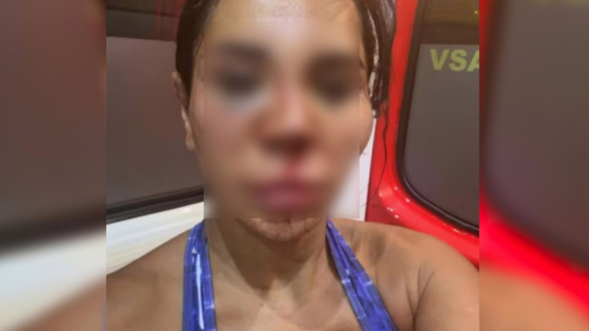 “Tentaram me desfigurar”: influenciadora é espancada dentro da própria casa – Imagem: reprodução/ metrópoles