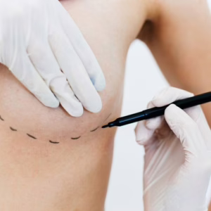 Nova lei amplia acesso a cirurgia reparadora de mama l Foto: GettyImages