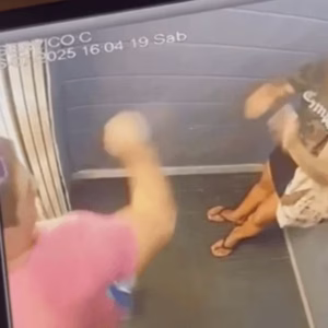 Mulher agredida com mais de 60 socos passa por cirurgia para reconstruir rosto. - Foto: Reprodução/Internet