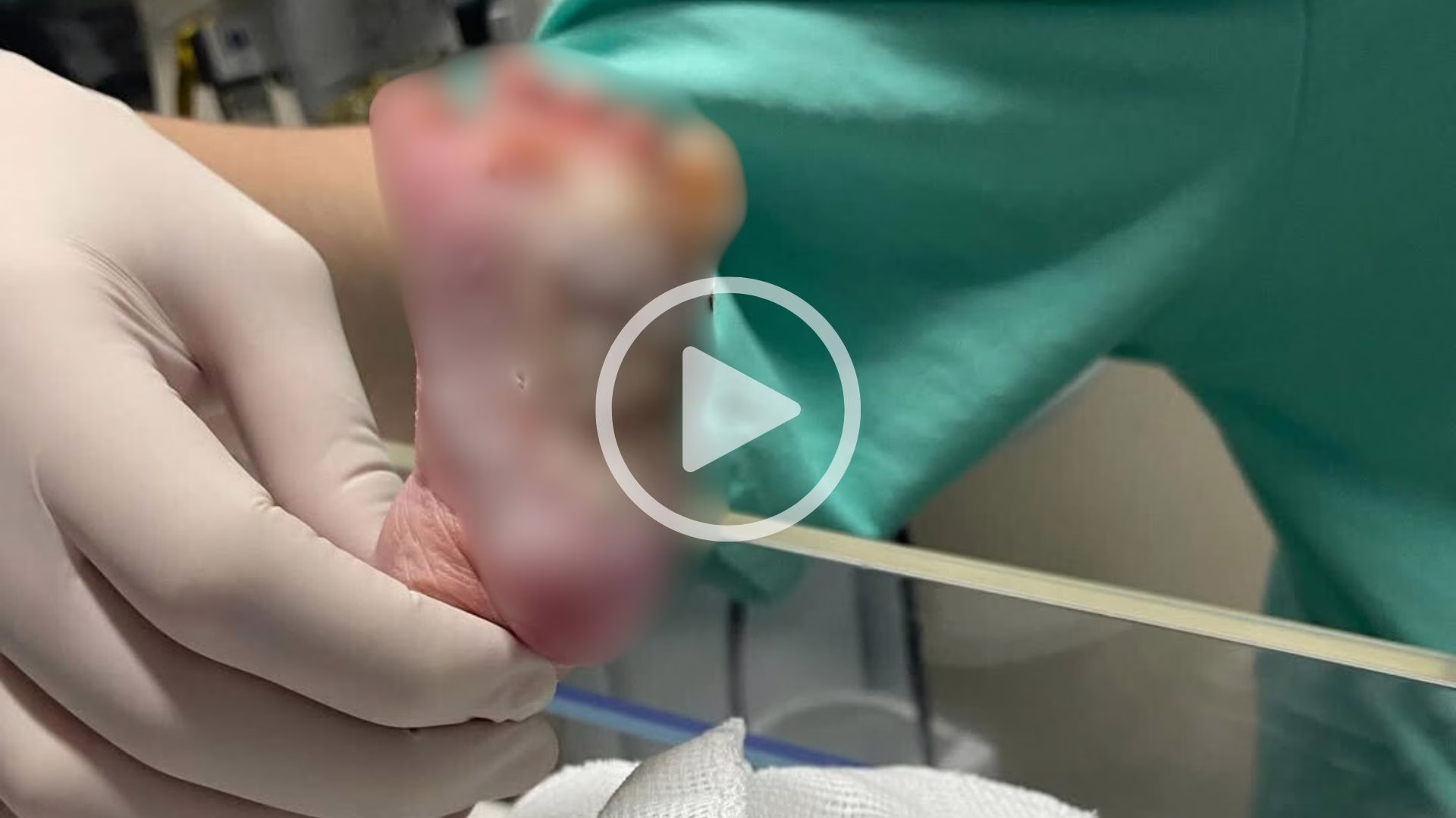VÍDEO: mãe denuncia que bebê teve pés queimados na maternidade de hospital | Foto: reprodução/ redes sociais