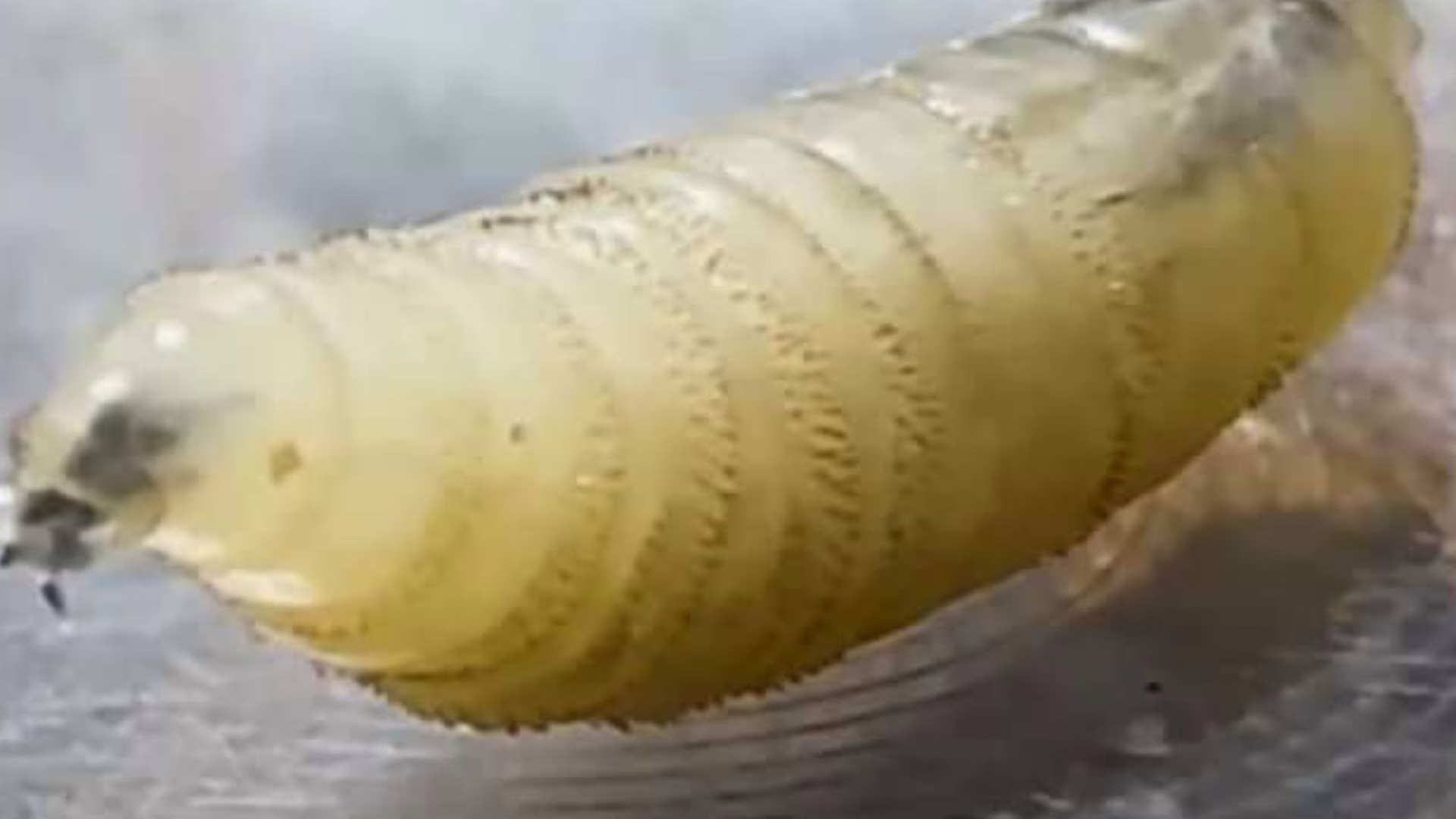 Parasita carnívoro é identificado em humano nos EUA – Imagem: reprodução/ SBT News Parasita carnívoro é identificado em humano nos EUA – Imagem: reprodução/ SBT News