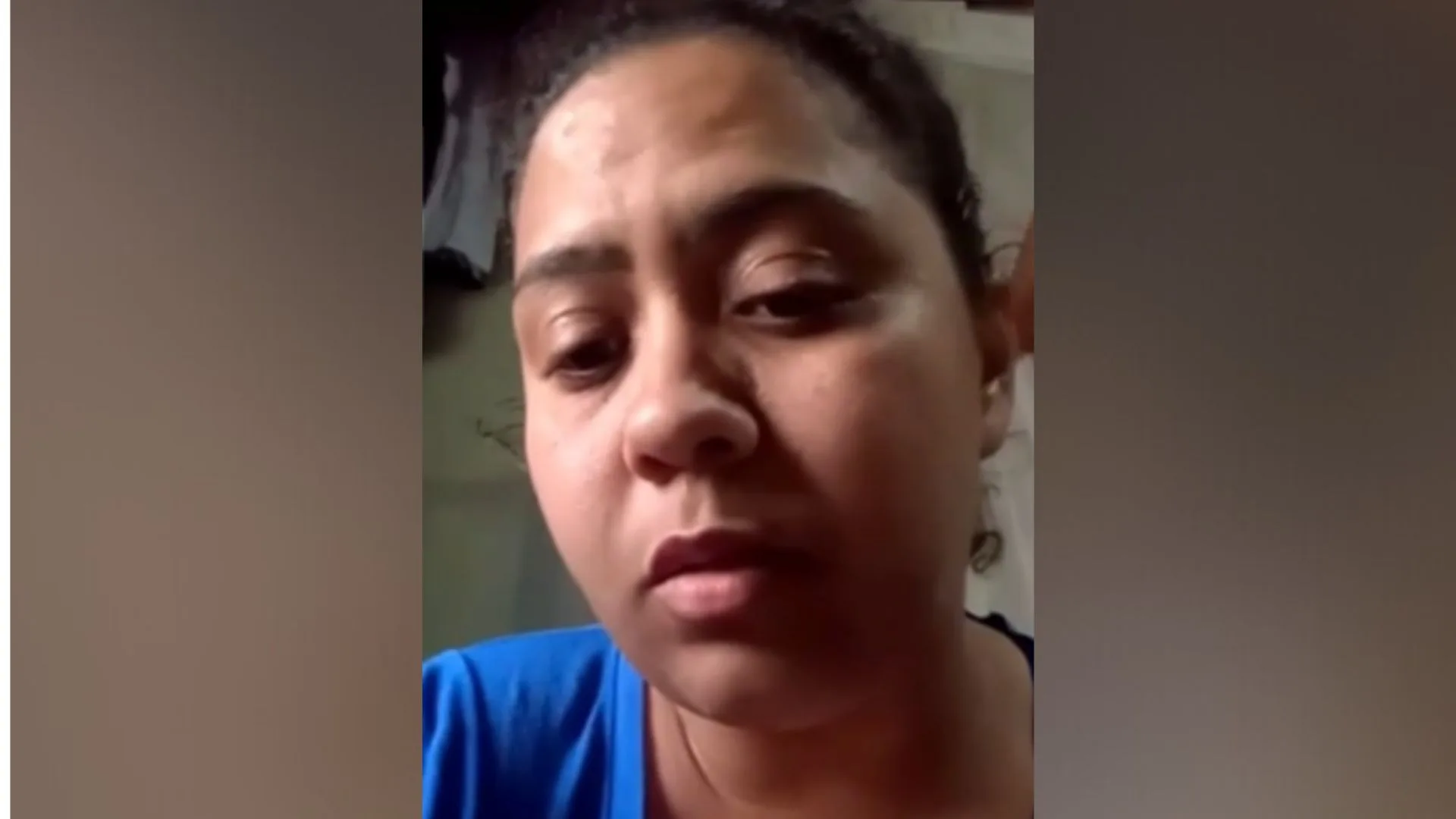 ‘Poderia ter acontecido algo pior’: mãe relata ataque de pitbull em escola de Florianópolis – Imagem: SCC SBT ‘Poderia ter acontecido algo pior’: mãe relata ataque de pitbull em escola de Florianópolis – Imagem: SCC SBT