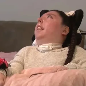 Completa 20 anos a americana que nasceu sem cérebro | Foto: Reprodução / Youtube WHAS11 | Metrópoles