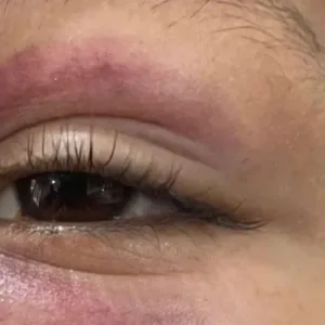 Menino autista é agredido durante brincadeira na rua | Foto: Metrópoles | Reprodução