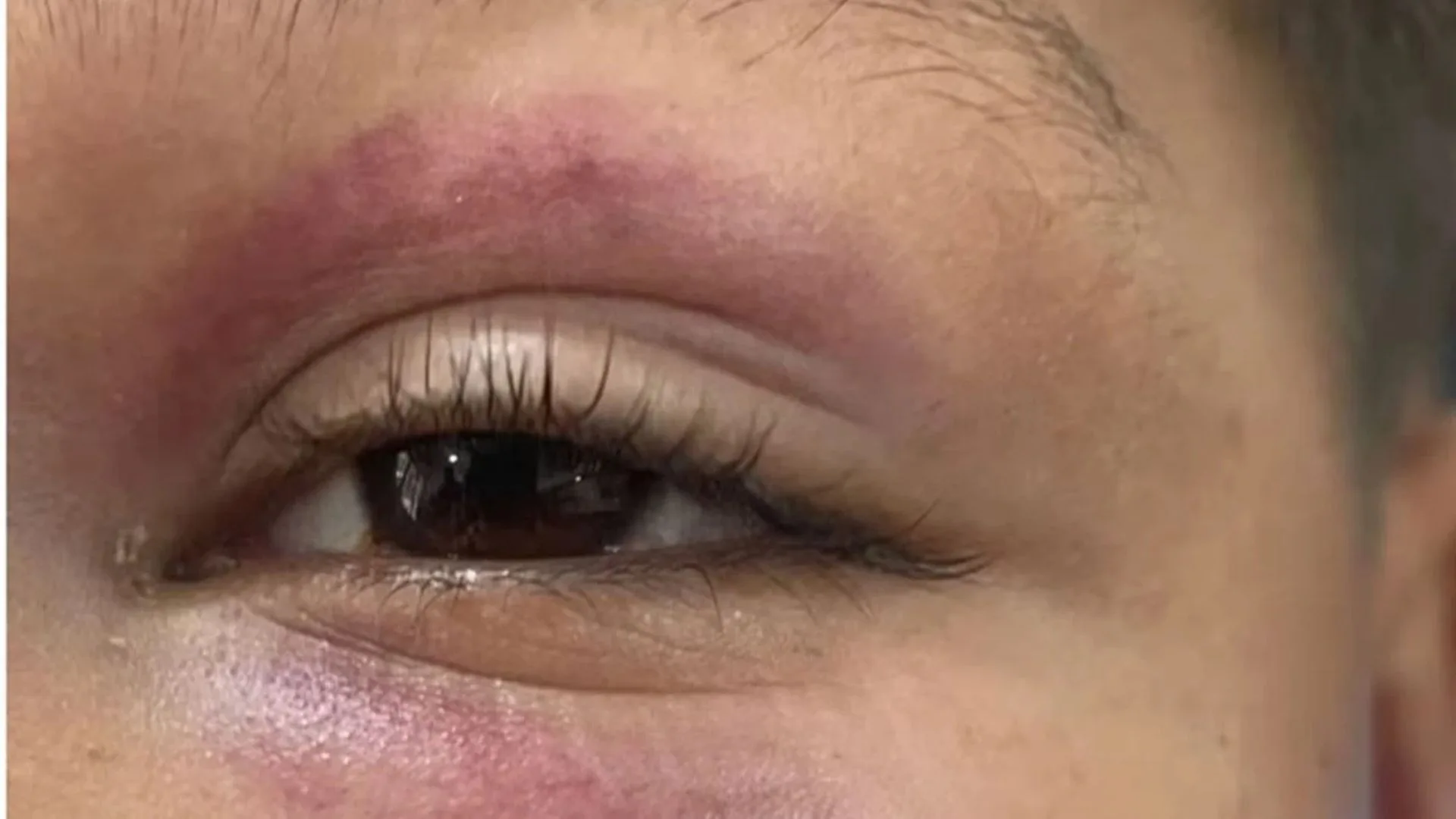 Menino autista é agredido durante brincadeira na rua | Foto: Metrópoles | Reprodução