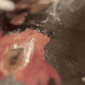 Condenado por cirurgias 'X-Tudo' médico tem três processos em dívida ativa no PROCON/SC | Fotos: Leticia Mello/Divulgação