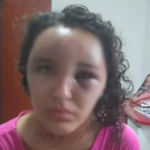 'Só sobrevivi porque fingi estar morta', diz jovem atacada em Hortolândia | Foto: reprodução / Redes Sociais. 