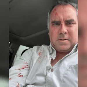 Pré-candidato a presidência do Peru é alvo de ataque a tiros | Foto: SBT News | Reprodução