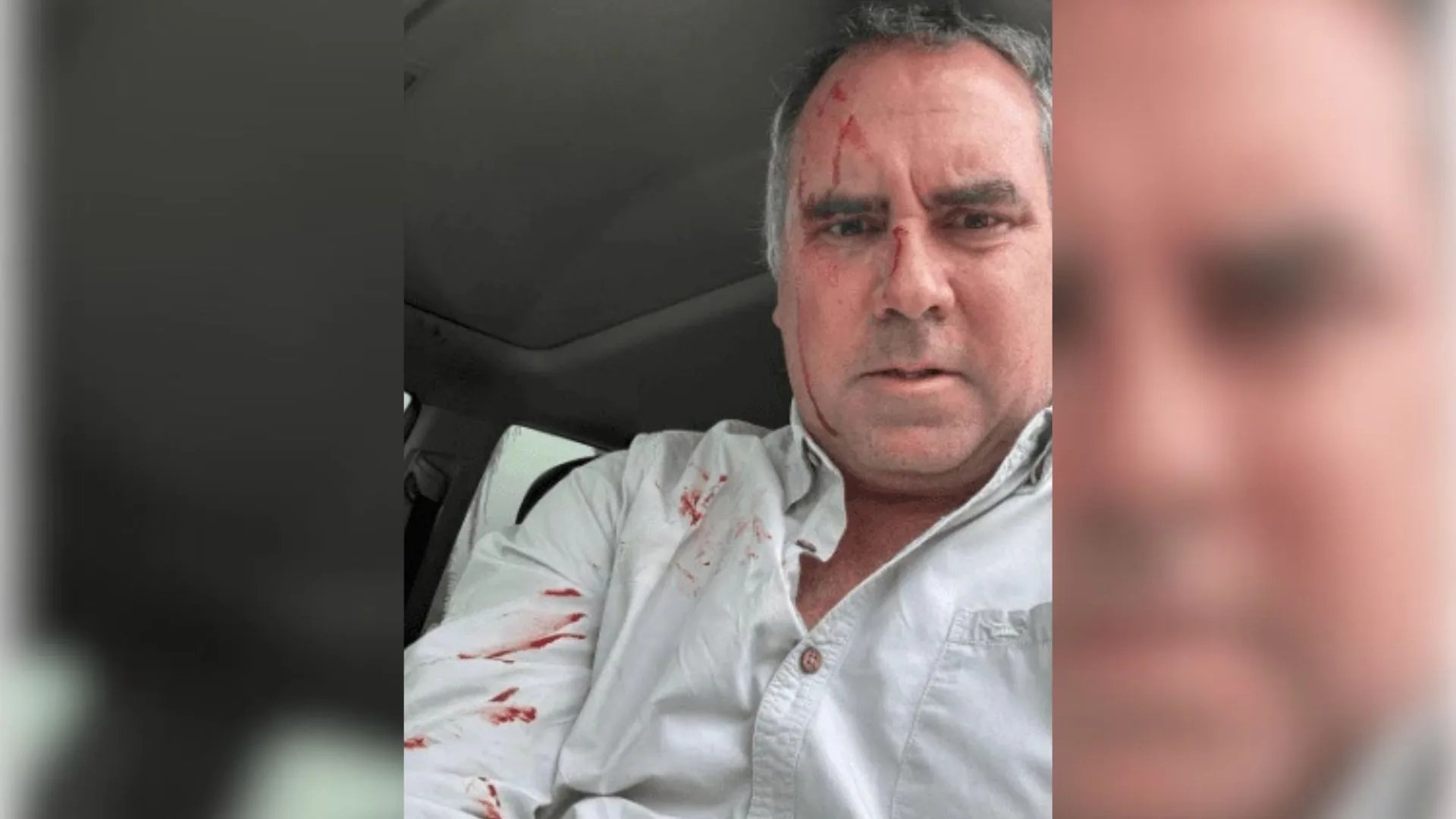 Pré-candidato a presidência do Peru é alvo de ataque a tiros | Foto: SBT News | Reprodução