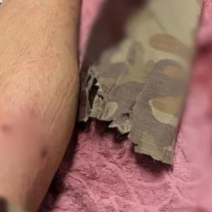 Policial é atacado por cachorro durante ocorrência em SC