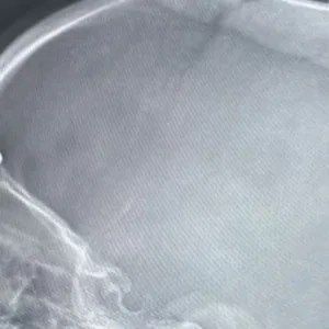 Criança cai da cama e fica com carregador cravado na testa - Imagem: reprodução/SBT