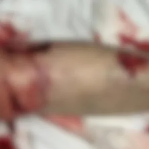 Funcionário da Celesc é atacado por pitbull em Joinville e fica gravemente ferido