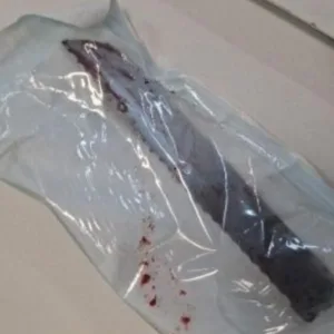 Mulher é esfaqueada no rosto e companheiro é preso em SC - Foto: PM