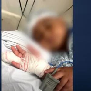 Criança de quatro anos perde parte do dedo em creche