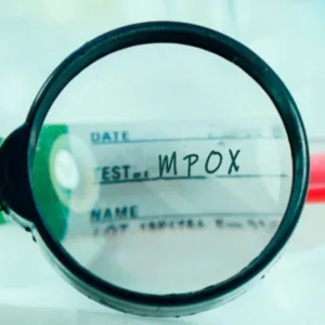 Saúde de SC investiga sete casos de Mpox no estado | Foto: Internet via Ministério da Saúde