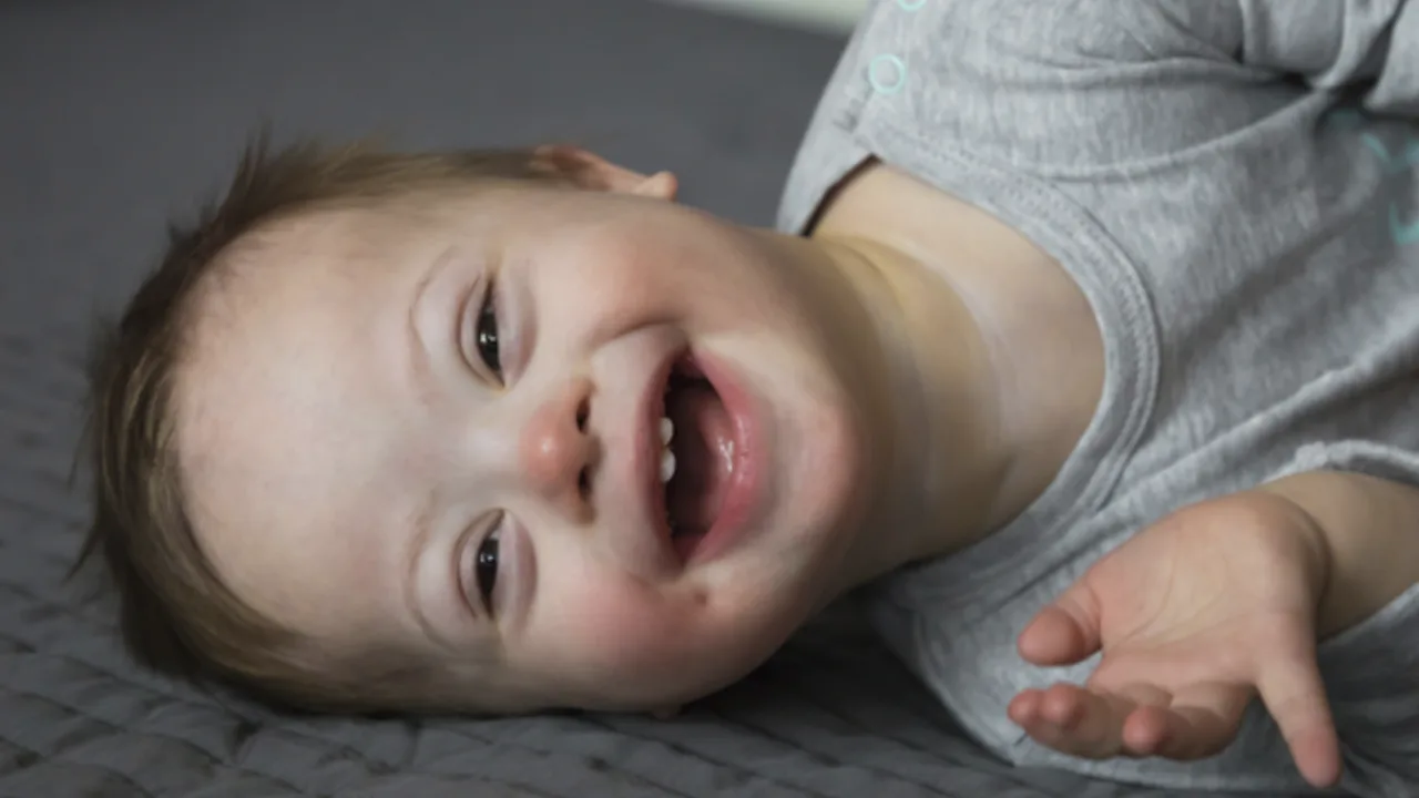 Dia Mundial da Síndrome de Down é comemorado neste sábado