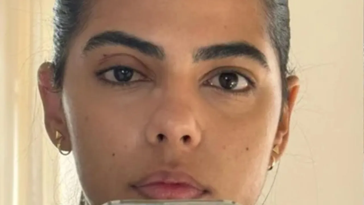 Mulher perde 70% da visão após ignorar sinais de glaucoma