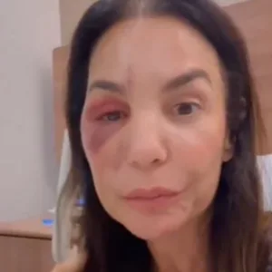 Síndrome vasovagal: entenda condição que fez Ivete desmaiar