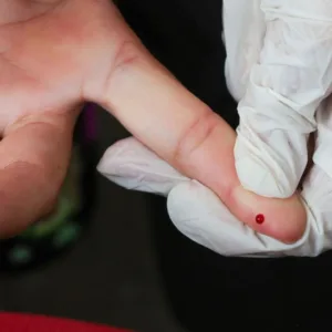 SUS amplia combate à dengue com teste rápido nas unidades de saúde | Foto: Fabio Rodrigues-Pozzebom/ Agência Brasil