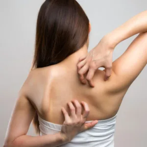 Após coceira persistente, mulher descobre doença neurológica