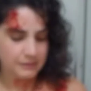 Justiça nega prisão de homem investigado por agredir vizinha em SC