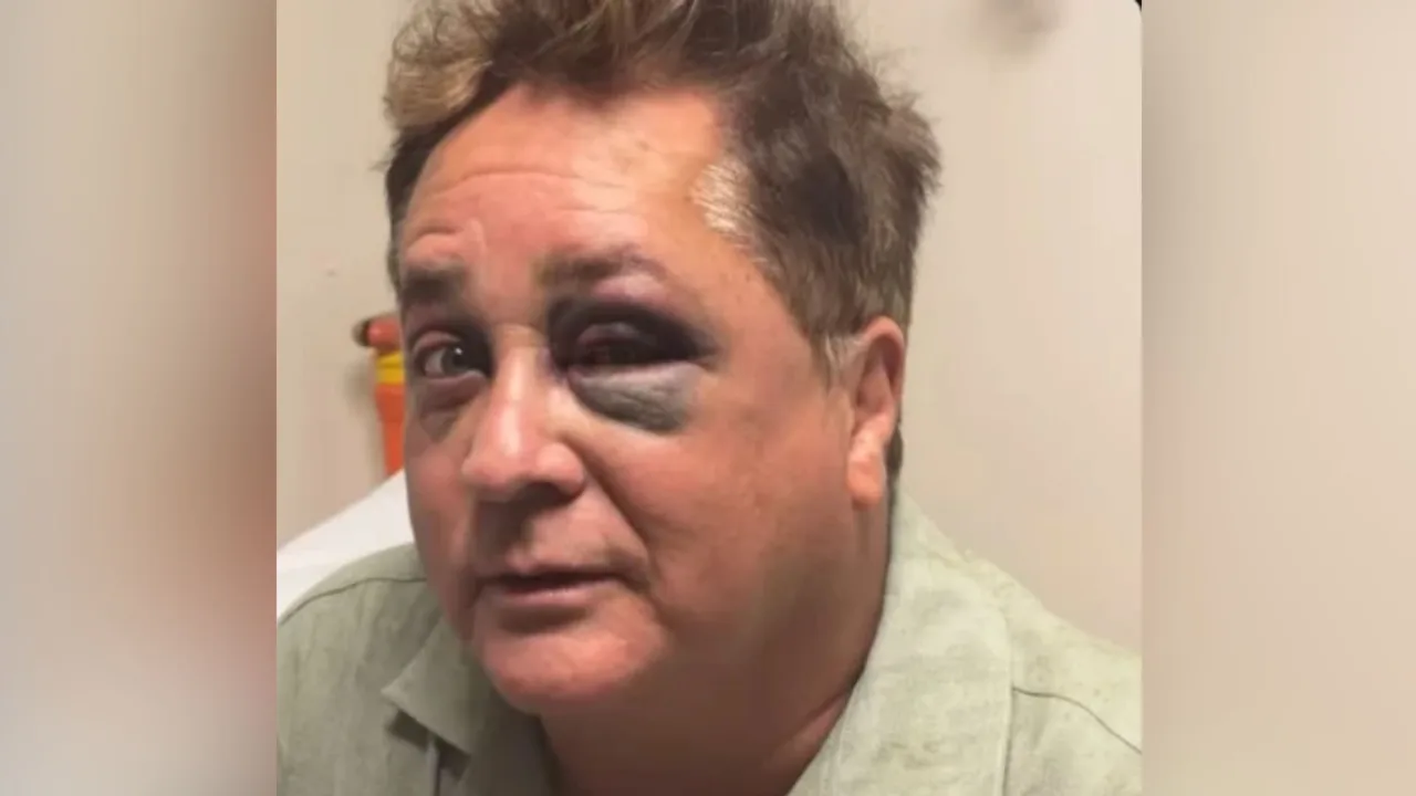 Poliana Rocha atualiza estado de saúde de Leonardo após queda no Pantanal