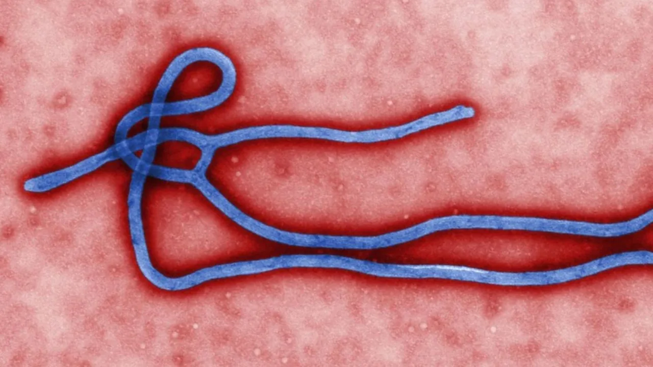 Ebola o que se sabe sobre os dois casos suspeitos no Brasil