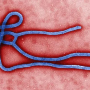 Ebola o que se sabe sobre os dois casos suspeitos no Brasil