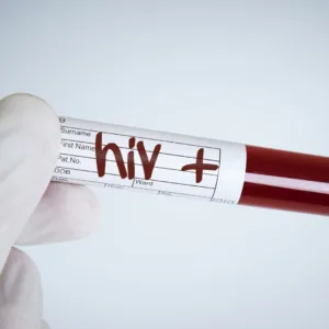 Homem é condenado a pagar R$ 60 mil após transmitir HIV à ex-companheira em SC