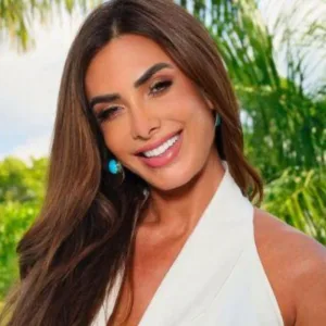 Nicole Bahls faz transplante capilar para “baixar” testa