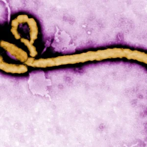 Paciente com suspeita de Ebola é internado em São Paulo