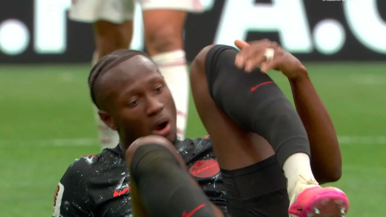 Koné fala pela primeira vez após fratura grave