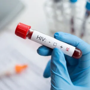 Florianópolis tem a 2ª maior taxa de HIV entre capitais | Foto: reprodução